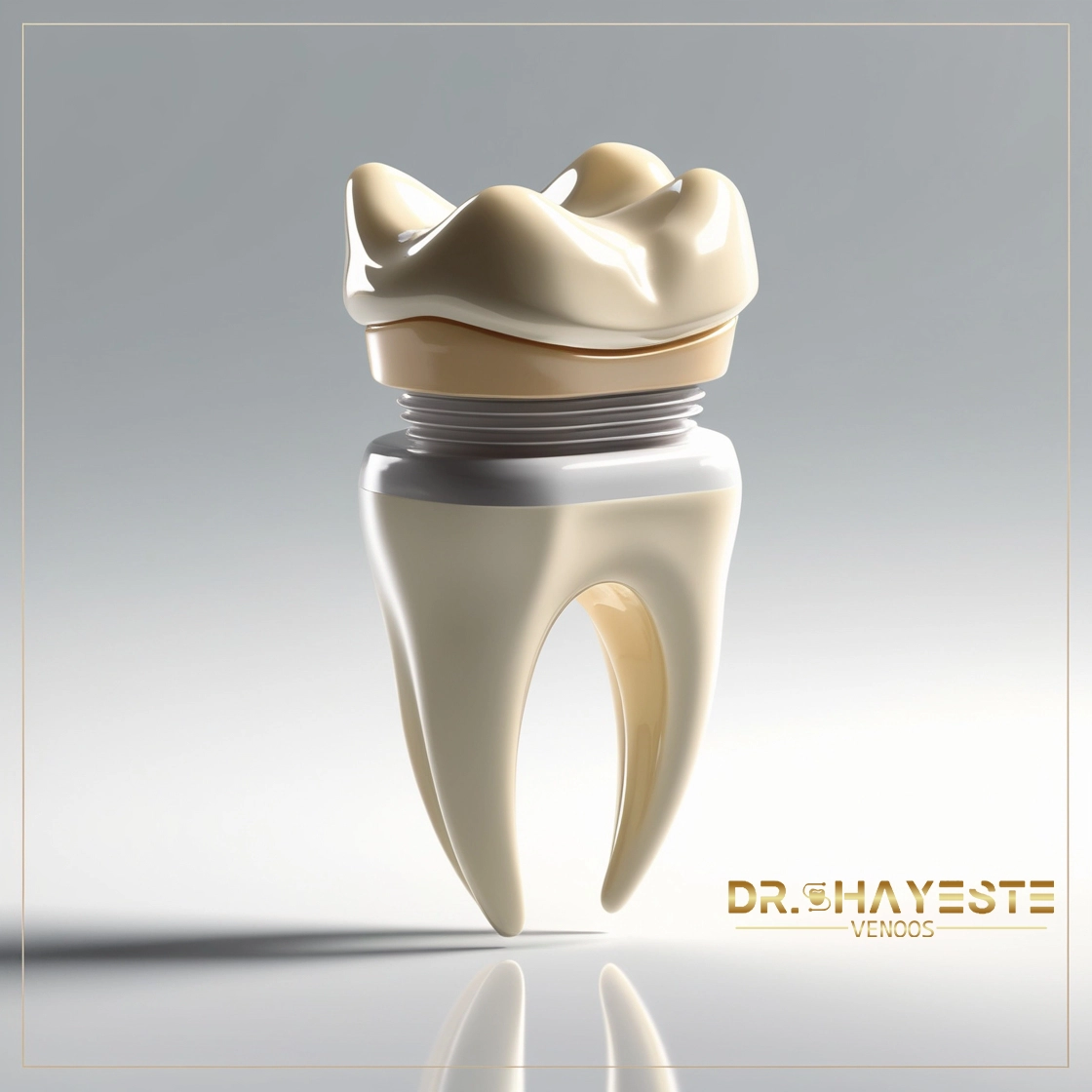 ایمپلنت دیجیتال دندان