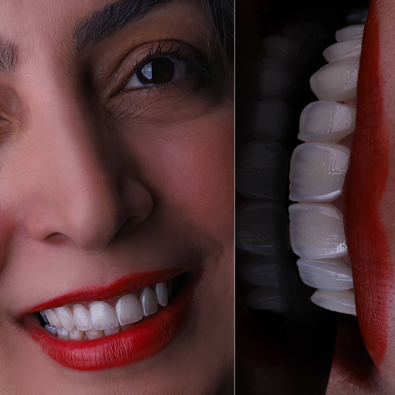 ایمپلنت اقساطی ۳۶ ماهه در تهران