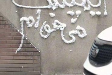 ایمپلنت اقساطی: راهکاری برای داشتن لبخندی زیبا بدون دغدغه مالی